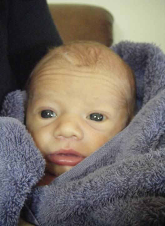 Ugliest Baby On...